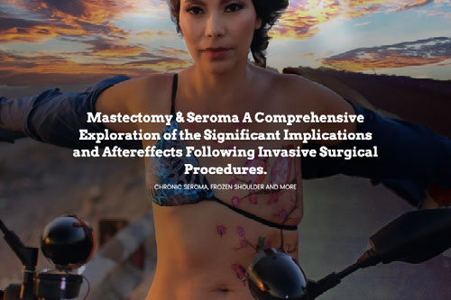 A Seroma, frozen shoulder after Mastectomy surgery